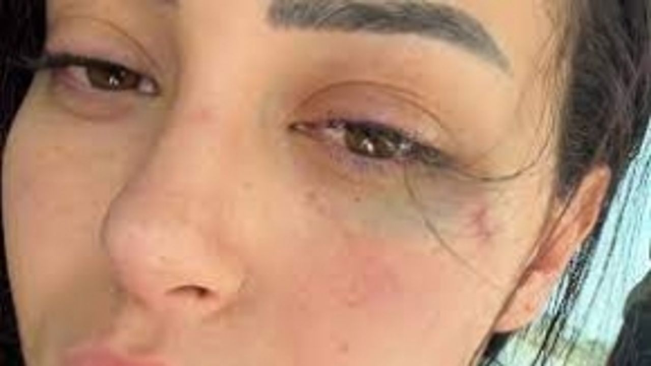 Güney Kıbrıs Rum Kesimi'nde Türk kızına saldırı!
