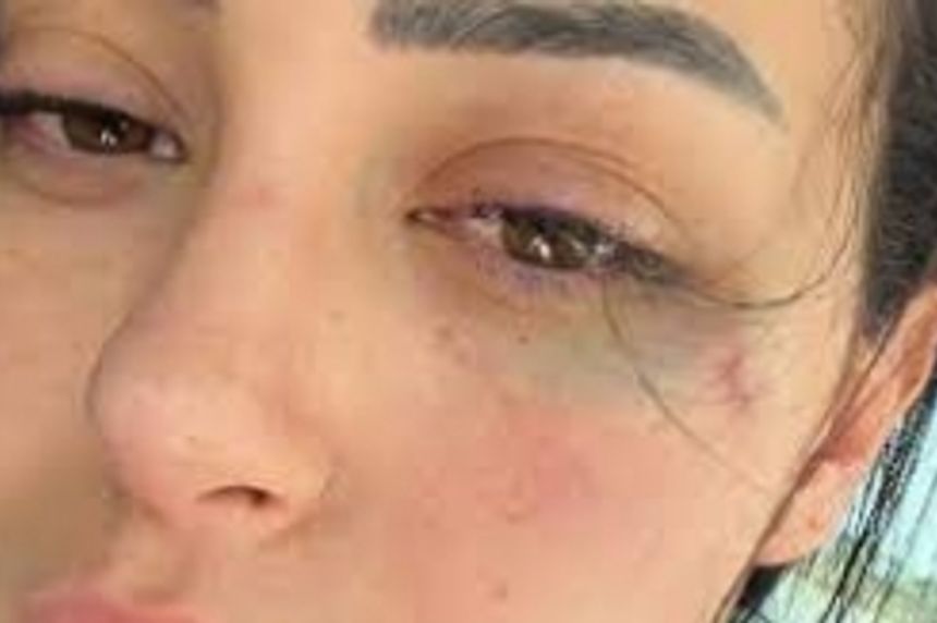 Güney Kıbrıs Rum Kesimi'nde Türk kızına saldırı!